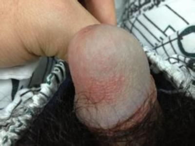 ��ͷ�ܲ�ͼƬ
