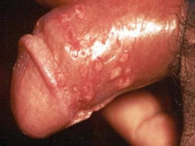 ��ͷ÷��ͼƬ
