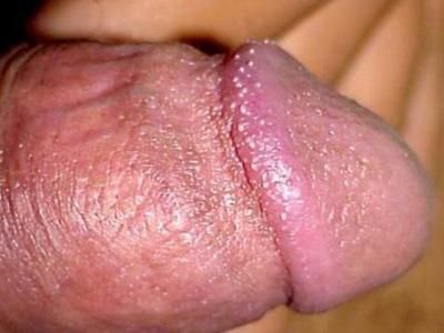 ��ͷ��ֳ������
