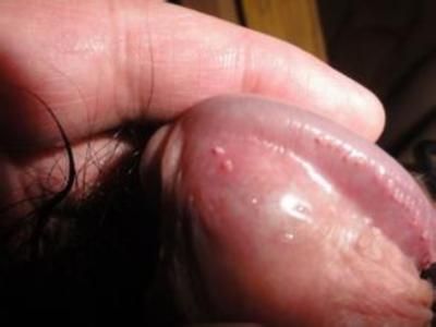 ��ͷ����ʪ��
